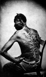 Peter, a whipped Louisiana slave, photographed in April 1863 and later distributed by abolitionists. (From Wikipedia.) 